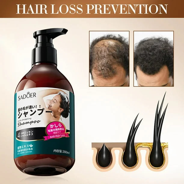 SADOER Anti Hair Loss Shampoo Anti-dandruff Hair Growth Shampoo - 300ml