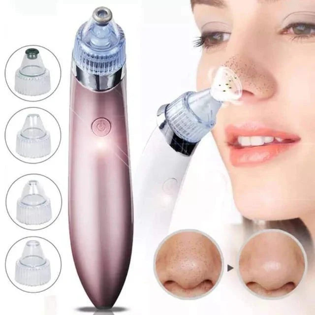 Rechargeable Blackhead Remover Machine | Premium Skincare & Beauty Products in Pakistan