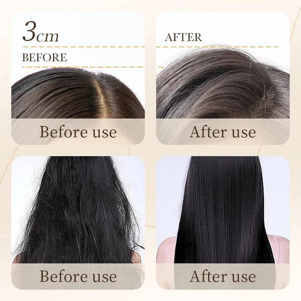 Bioaqua Rice Raw Pulp Removal Dandruff Shampoo - 500ml