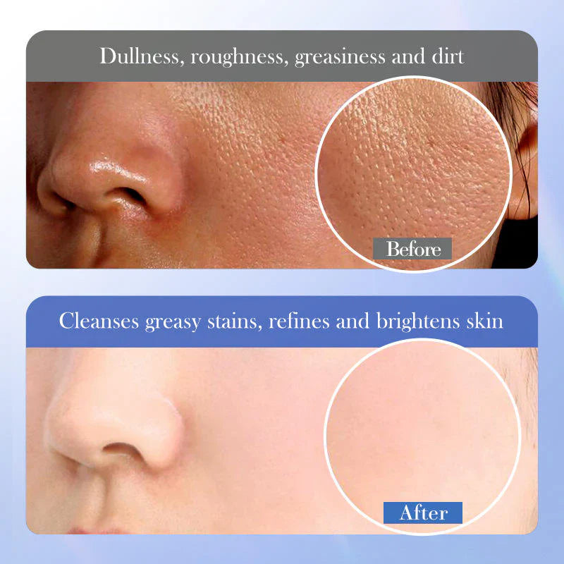 BIOAQUA Ceramide Salicylic Acid Facial Cleanser - 100ml | Premium Skincare & Beauty Products in Pakistan