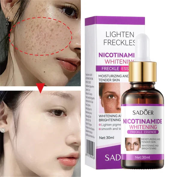 Sadoer Niacinamide Whitening Freckles Serum 30ml | Premium Skincare & Beauty Products in Pakistan
