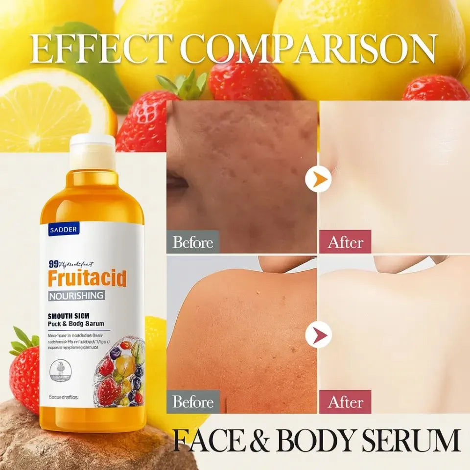 Sadoer Fruit Acid Face & Body Serum - 500ml