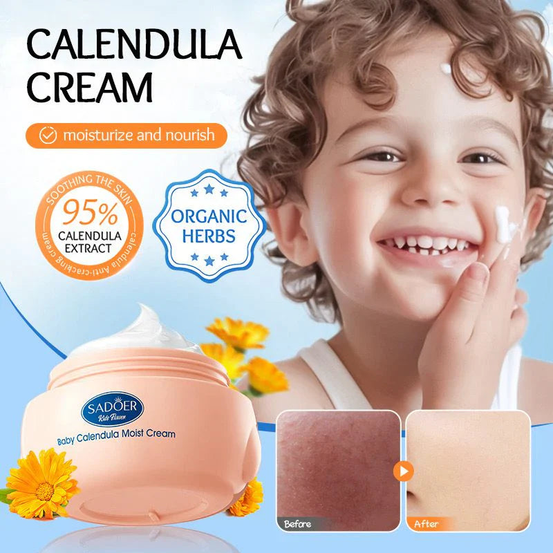 Sadoer Calendula Amino Acid Formula Baby Moist Cream – 50 g | Premium Skincare & Beauty Products in Pakistan