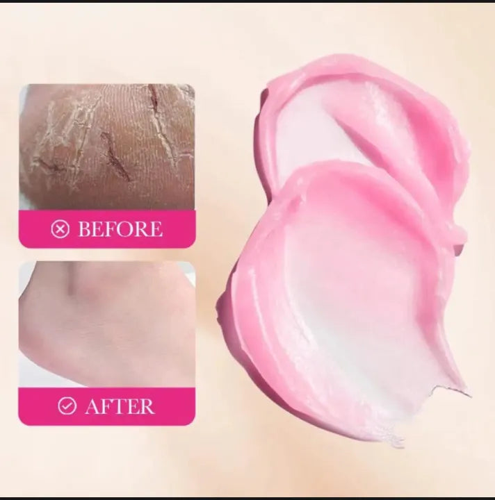 Sadoer Anti Dead Skin Squalene Peach Repair Cream - 70g