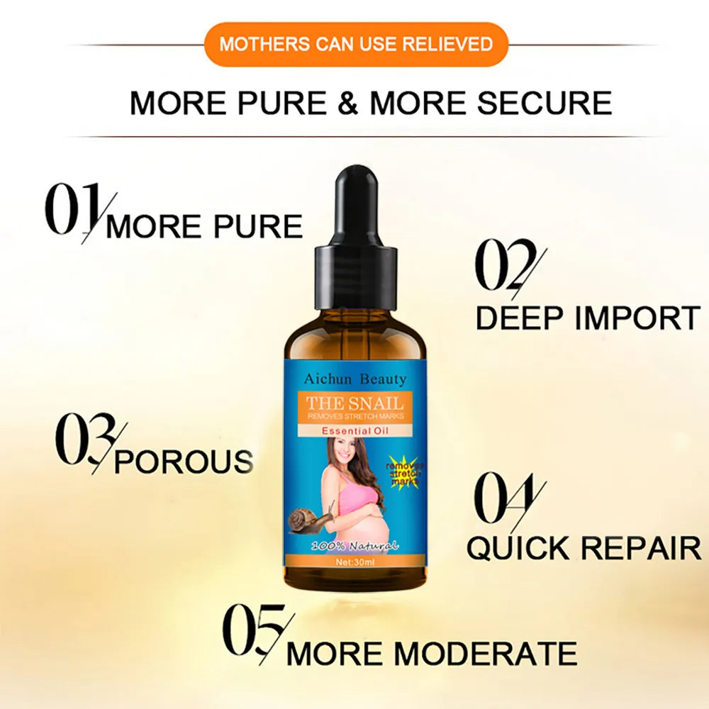 Aichun Beauty The Snail Remove Stretch Marks Essential Oil - 30ml