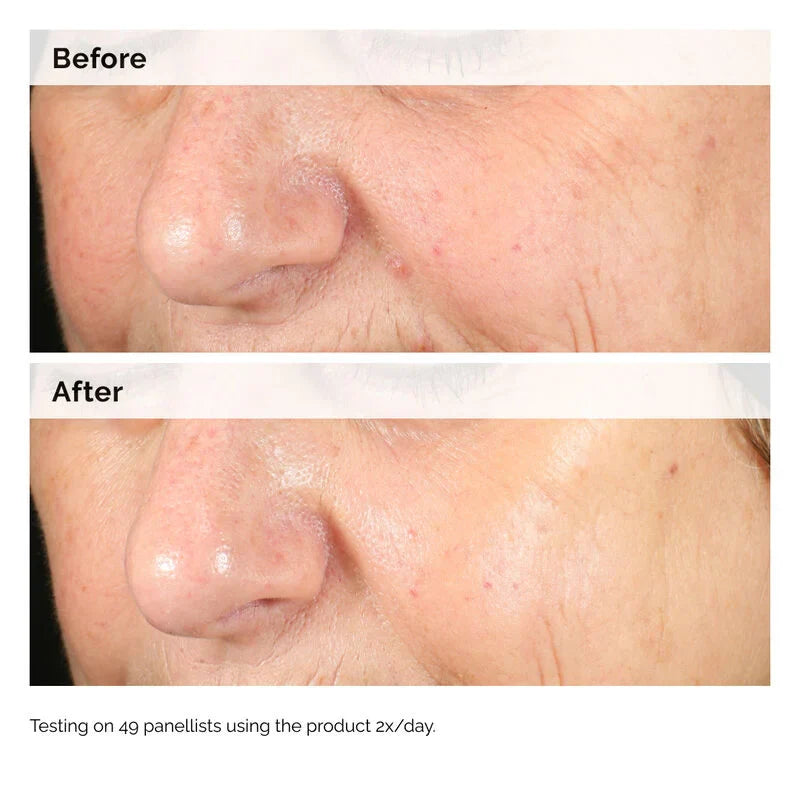The Ordinary Alpha Arbutin 2% + HA Serum - 30ml