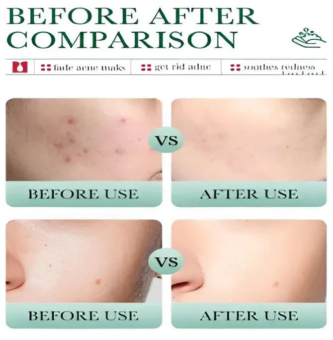 Bioaqua Salicylic Acid Cleanser | Premium Skincare & Beauty Products in Pakistan