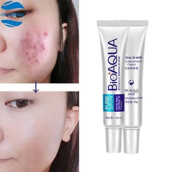 BIOAQUA- Acne Removal Pure Skin Cream - 30g | Premium Skincare & Beauty Products in Pakistan