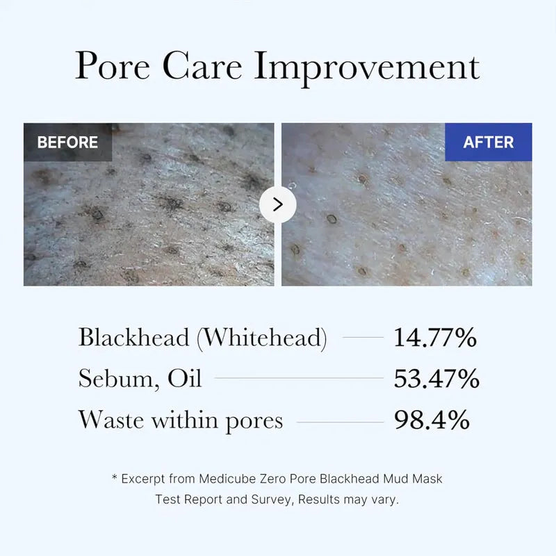Medicube Zero Pore Blackhead Mud Mask  - 100g - Free Applicator | Premium Skincare & Beauty Products in Pakistan