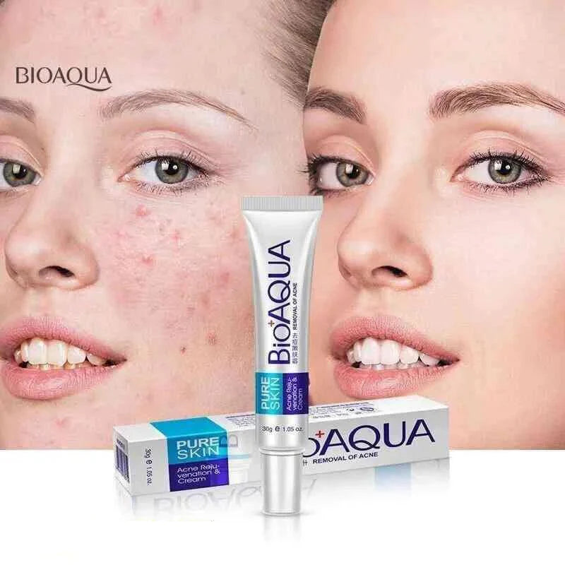 Bioaqua Acne Removal Cream Spot-Free Skin | Premium Skincare & Beauty Products in Pakistan