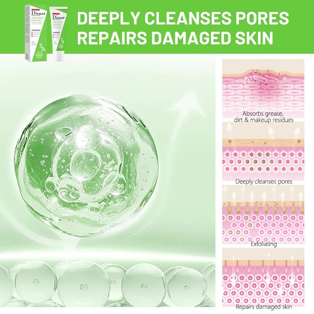 Disaar ceramide Anti-Acne Facial Gel Moisturizing Face Gel - 30g
