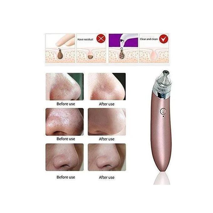Electric Blackheads Remover Beauty Tool