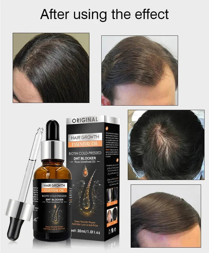 Hair Growth Essential Oil Biotin Cold-Pressed DHT Blocker - 30ml