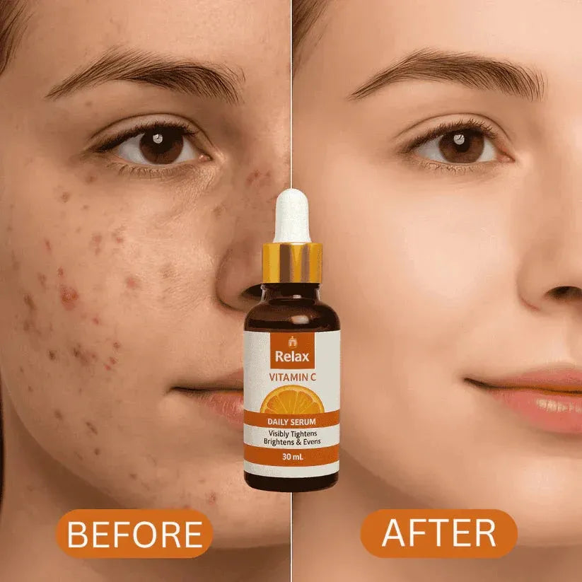 Relax Vitamin C Daily Serum For Bright and Healthy Skin - 30ml | Premium Skincare & Beauty Products in Pakistan
