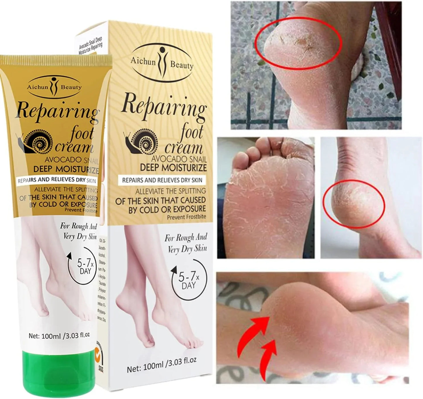 AICHUN BEAUTY Repairing Foot Cream - 100g