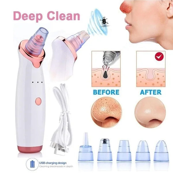5-in-1 Multi-functional Blackhead Removal Device | Premium Skincare & Beauty Products in Pakistan