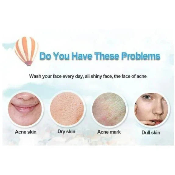 Bioaqua Acne Removal Cream Spot-Free Skin | Premium Skincare & Beauty Products in Pakistan