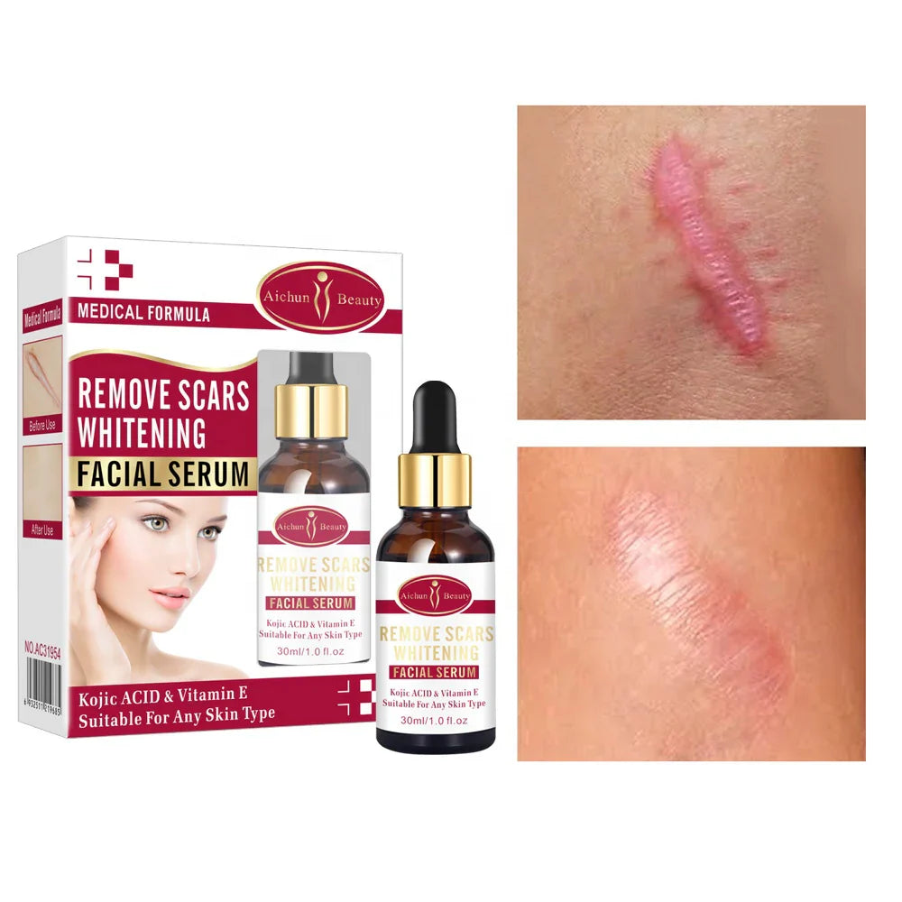Aichun Beauty Remove Scars Whitening Facial Serum 30 ML