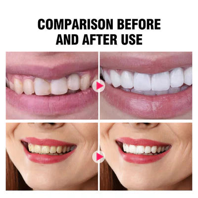 Aichun Beauty Teeth Coconut Black Bamboo Charcoal Toothpaste - 100g