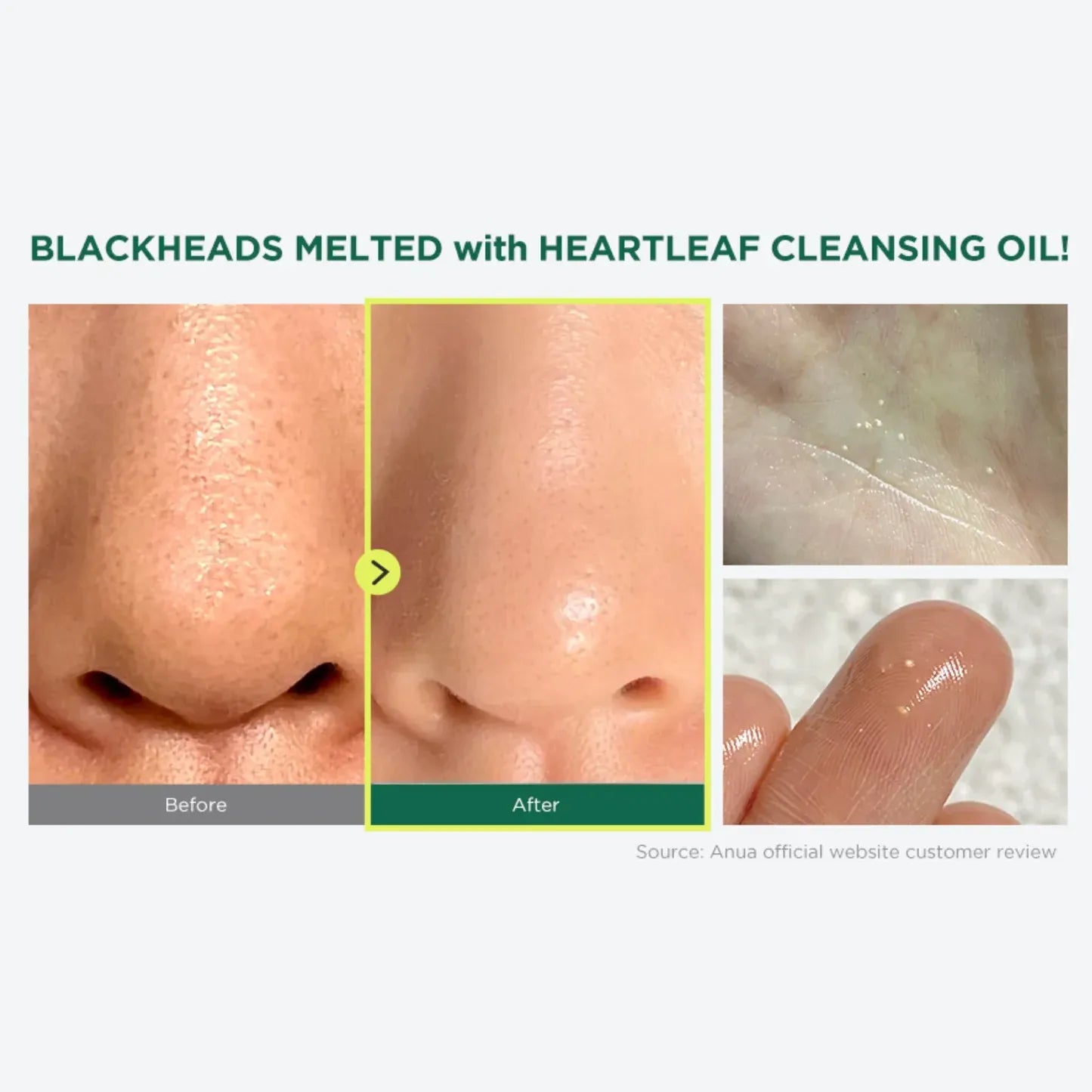 Anua Heartleaf Pore Control Cleansing Oil - 200ml | Premium Skincare & Beauty Products in Pakistan