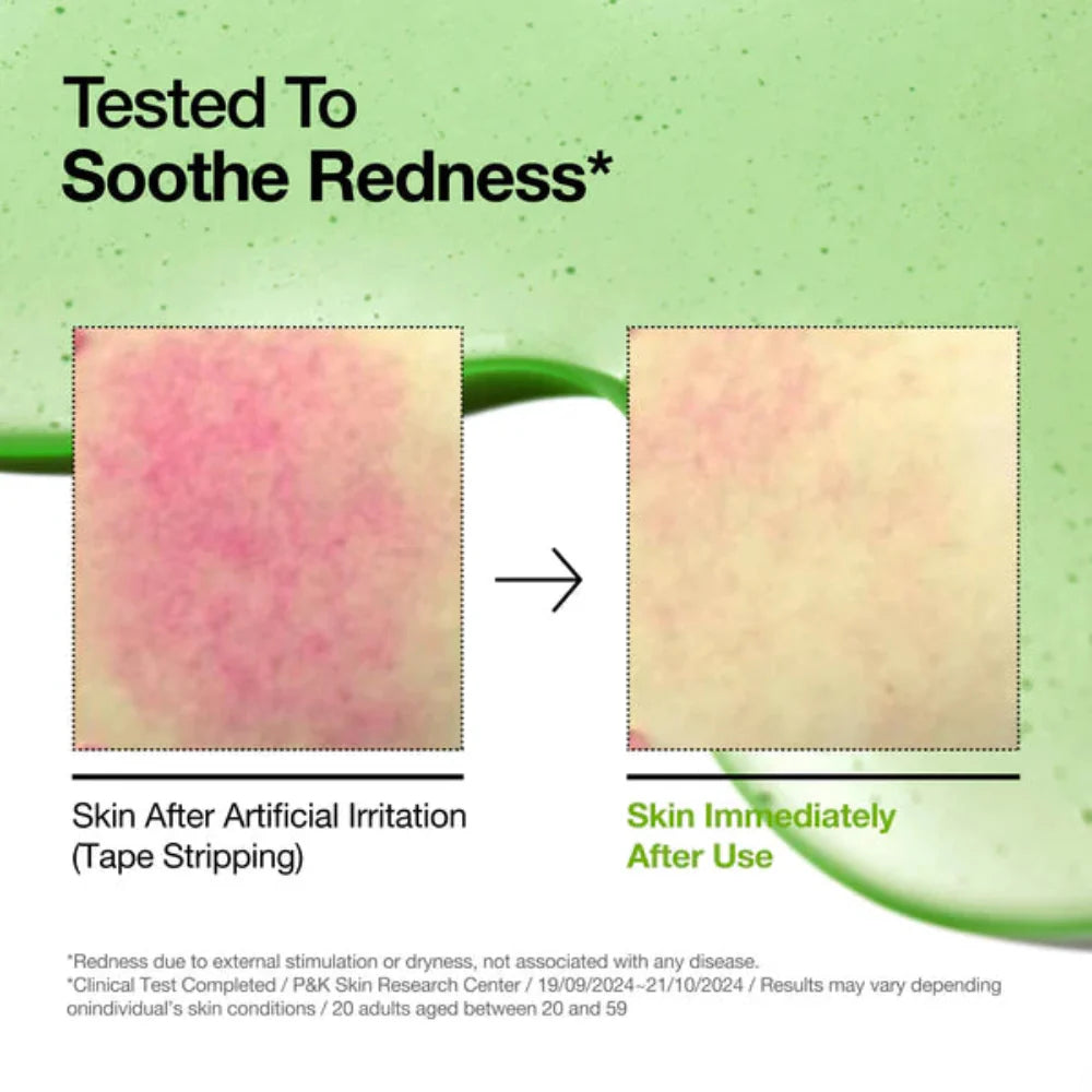 Anua Azelaic Acid 10+ Hyaluron Redness Soothing Serum - 30ml | Premium Skincare & Beauty Products in Pakistan