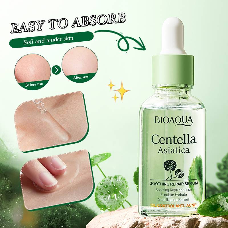 Bioaqua Centella Asiatica Soothing Repair Anti Acne Face Serum Essence - 30ml