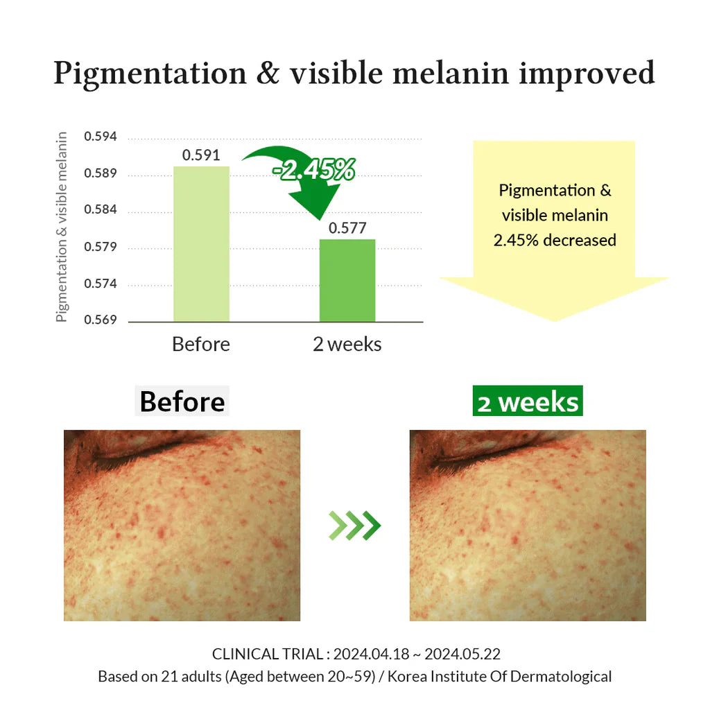 Dr.Althea Gentle Vitamin C Serum - 30ml