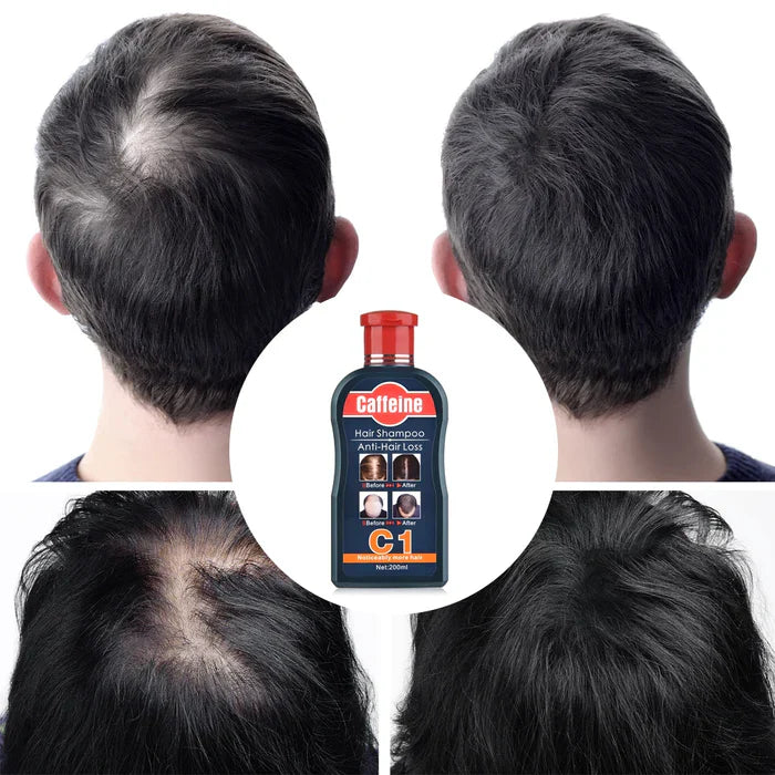 Pei Mei Caffeine Hair Shampoo Anti-Hair Loss - 200ml