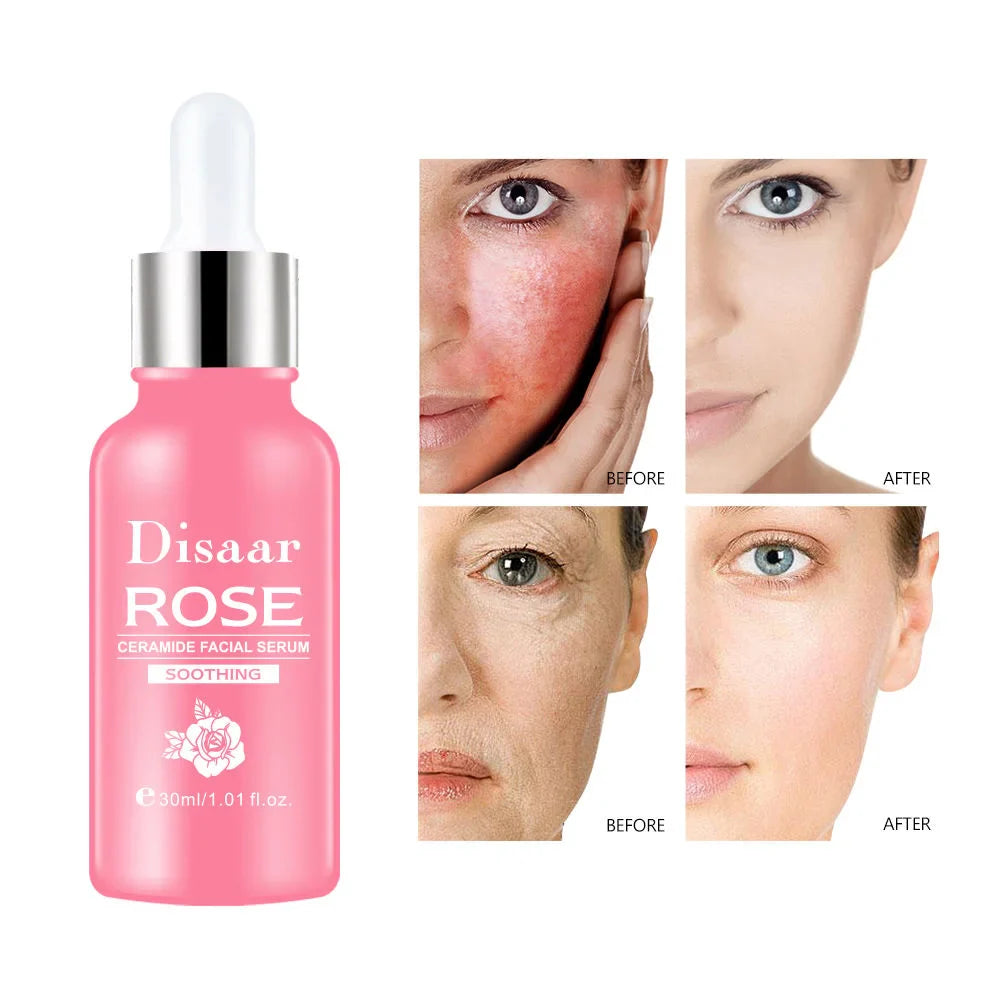 DISAAR  Rose & Ceramide Soothing Facial Serum - 30ml