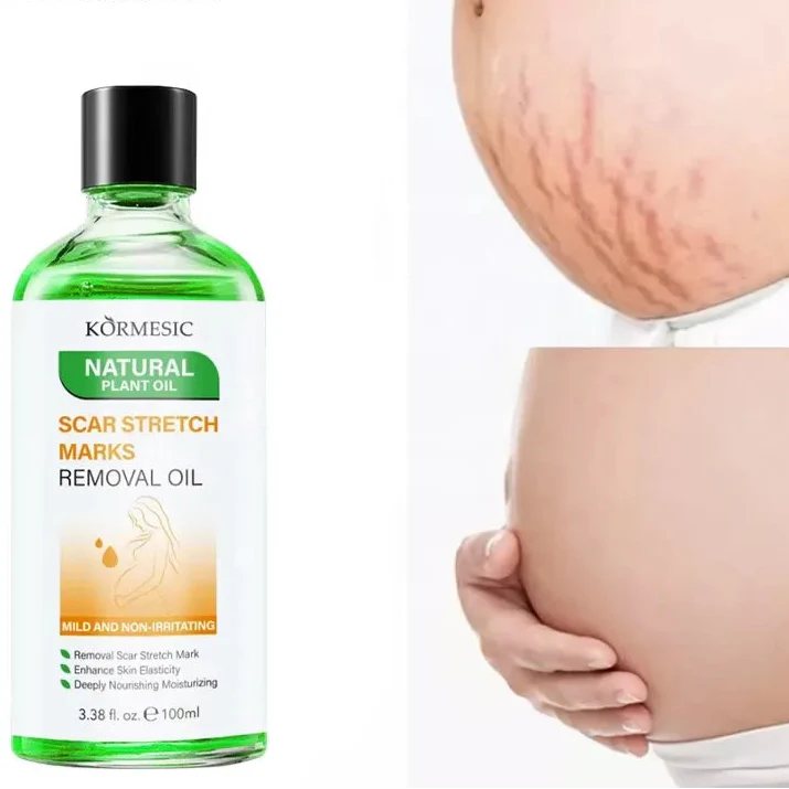 KORMESIC Skincare for Scratches Oil Marks Removal extra Virgin Mark - 100ml