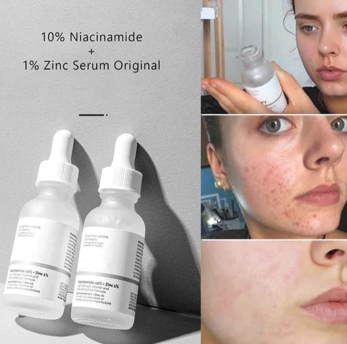 The Ordinary Hyaluronic Acid 2% + B5 Serum  - 30ml