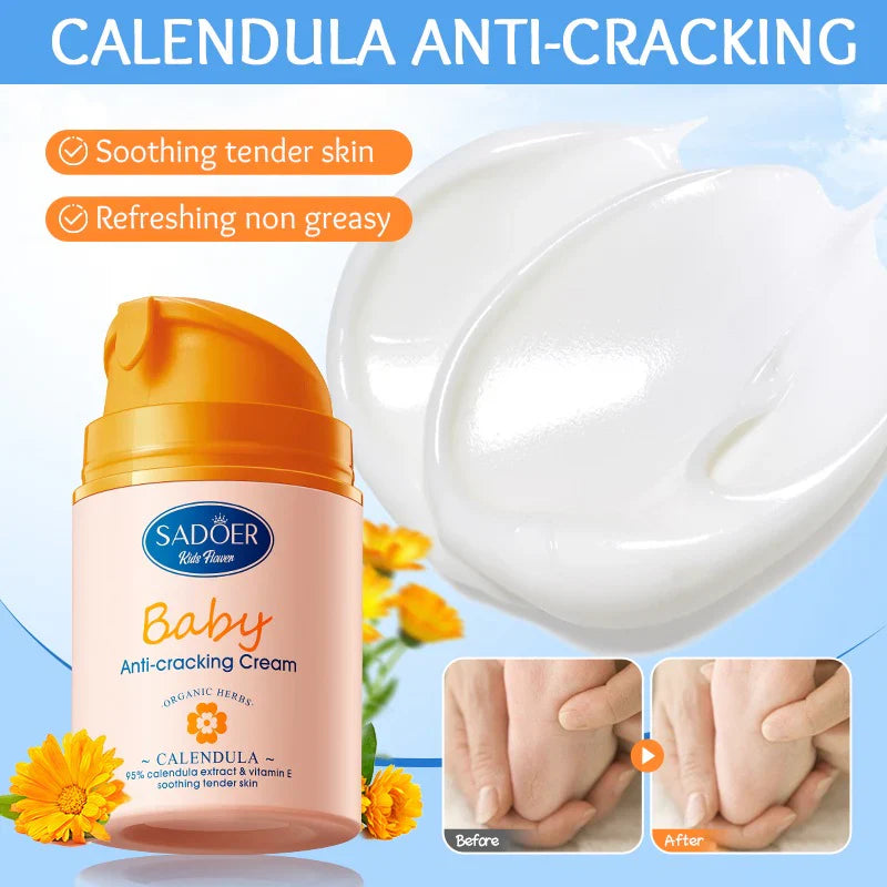 SADOER Baby Calendula Vitamin E Gentle Soothing Anti-Repair Cream - 50g