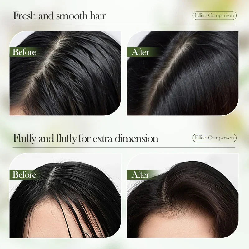 SADOER Rosemary Volumizing Anti-Dandruff Anti-Itch Shampoo