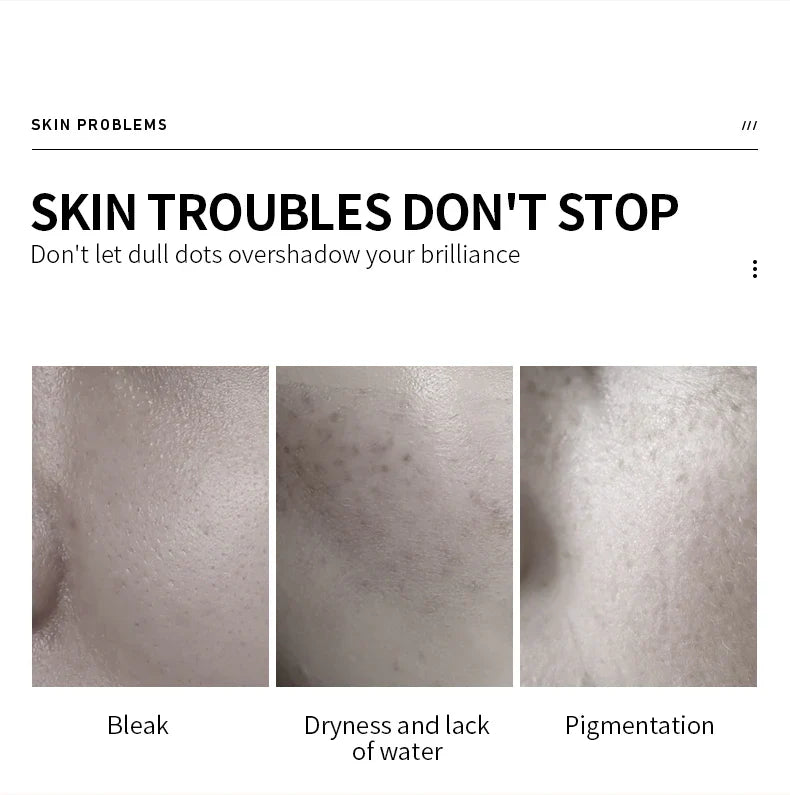 VEZE Moisturizing for the face, pore reduction, freckles, and smooth - 100ml