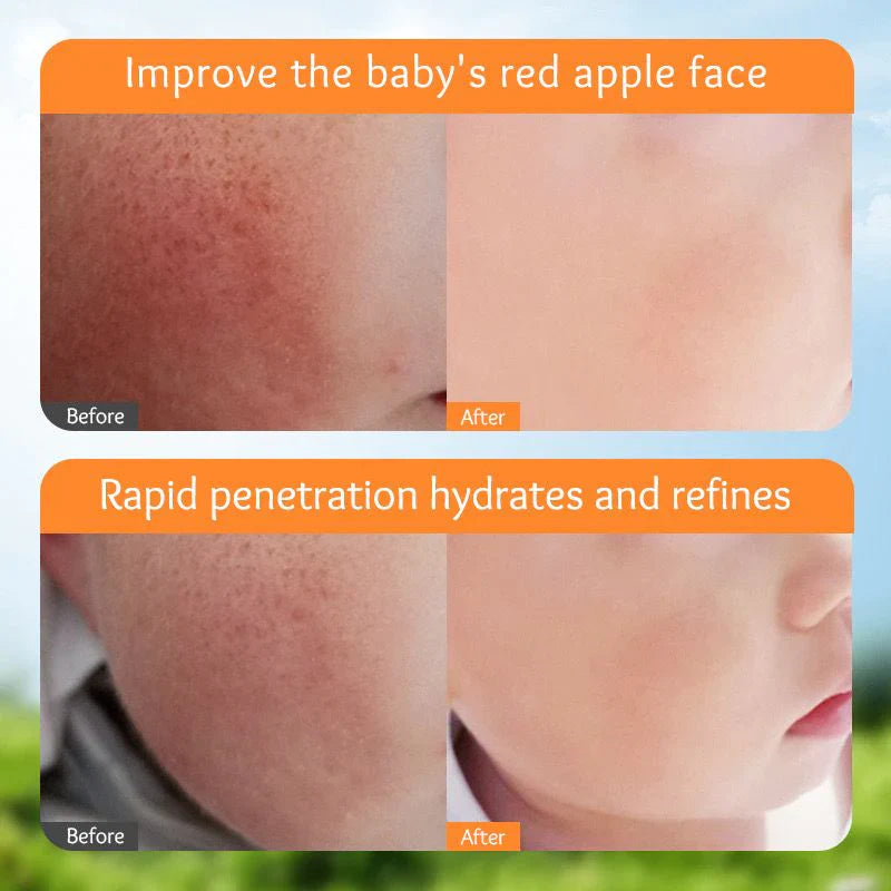 Sadoer Calendula Amino Acid Formula Baby Moist Cream – 50 g | Premium Skincare & Beauty Products in Pakistan