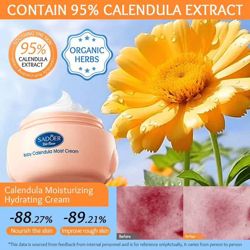 Sadoer Calendula Amino Acid Formula Baby Moist Cream – 50 g | Premium Skincare & Beauty Products in Pakistan