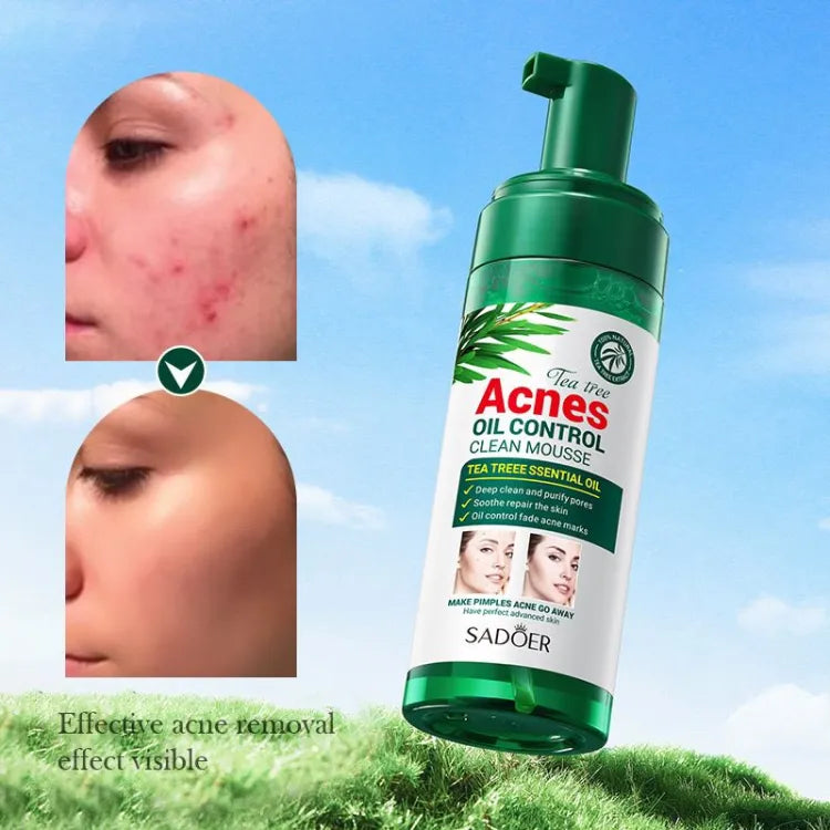 Sadoer Mousse Facial Cleanser Tea Tree 150g