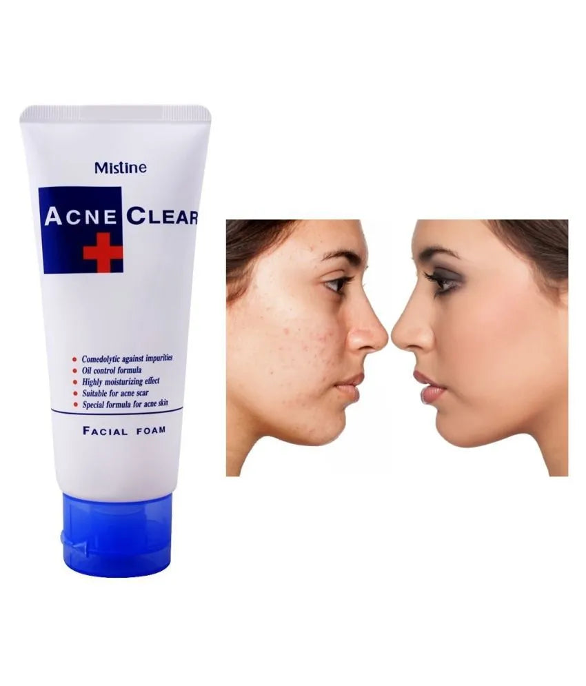 Mistine Acne Clear Facial Foam - 85ml | Premium Skincare & Beauty Products in Pakistan
