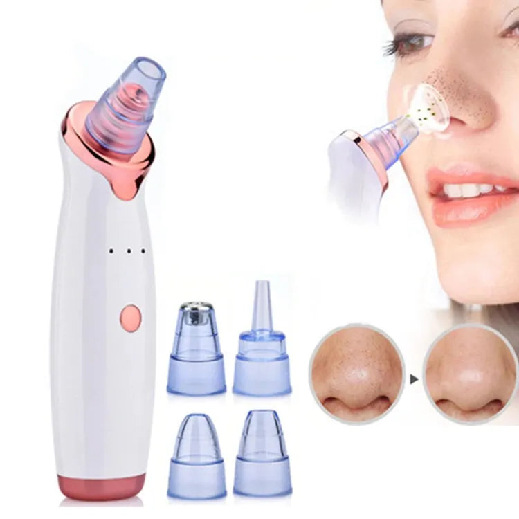 5-in-1 Multi-functional Blackhead Removal Device | Premium Skincare & Beauty Products in Pakistan