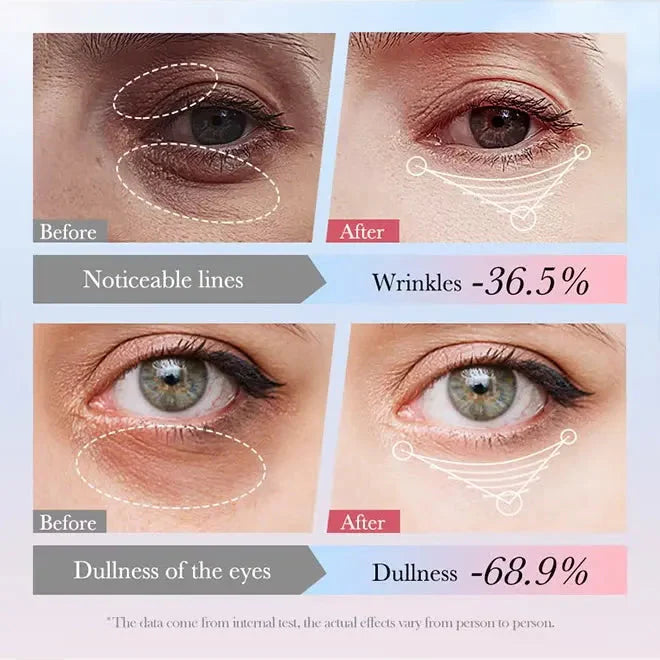 SADOER 4in1 Roll-on Moisturizing Eye Cream - 20gm