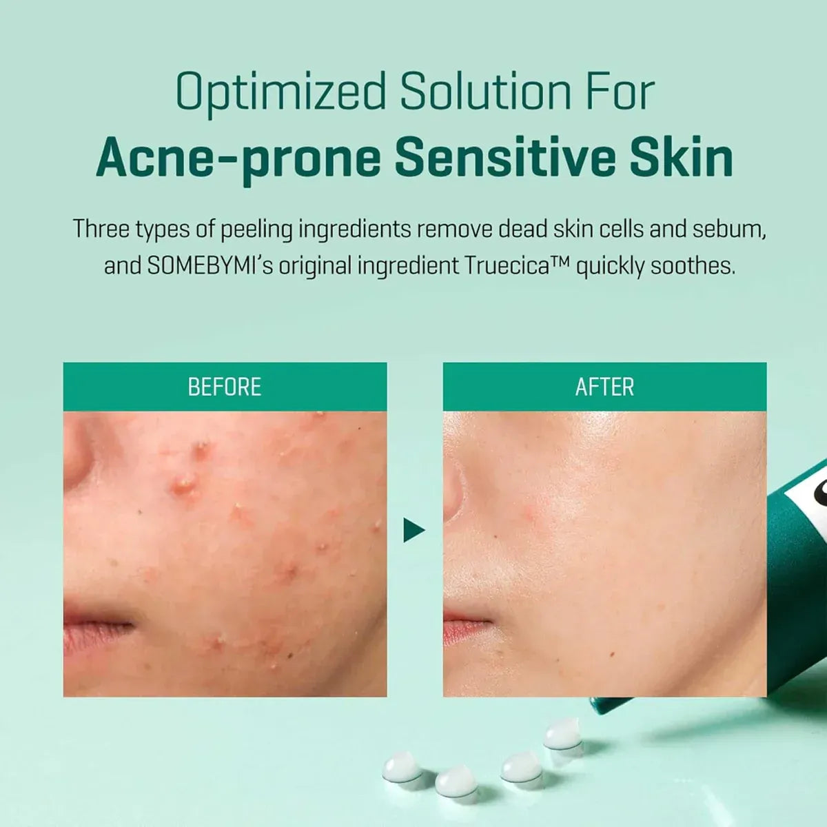 Some By Mi 14-Day Spot Treatment - 30ml