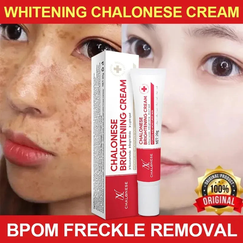 CHALONESE Brightening Cream Serum – 20g | Premium Skincare & Beauty Products in Pakistan