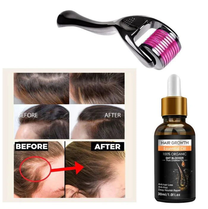 Pack Of 02 Hair Growth Oil Derma Roller - 0.55mm